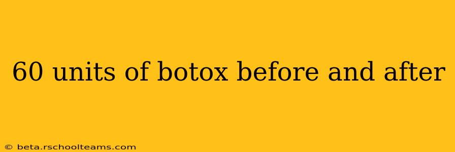 60 units of botox before and after