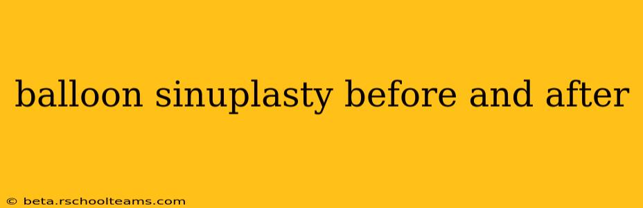 balloon sinuplasty before and after