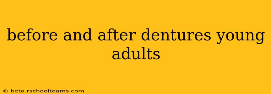 before and after dentures young adults