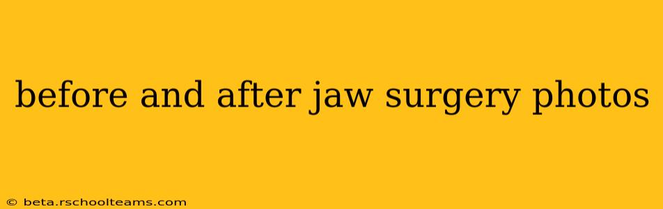 before and after jaw surgery photos