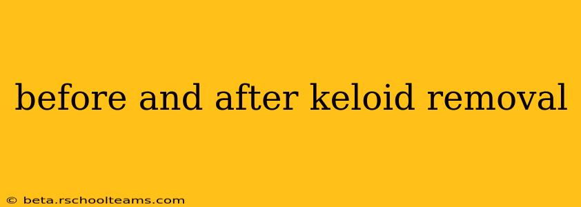 before and after keloid removal