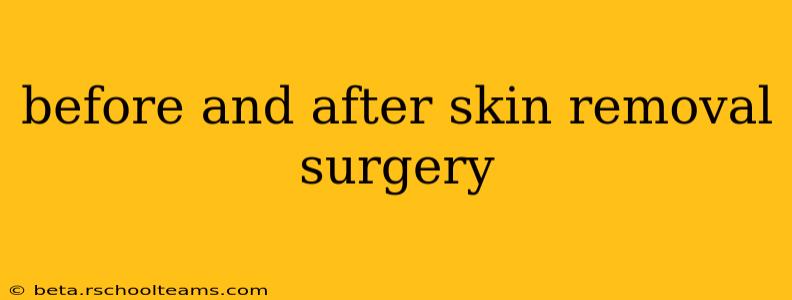before and after skin removal surgery