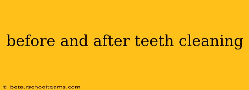 before and after teeth cleaning