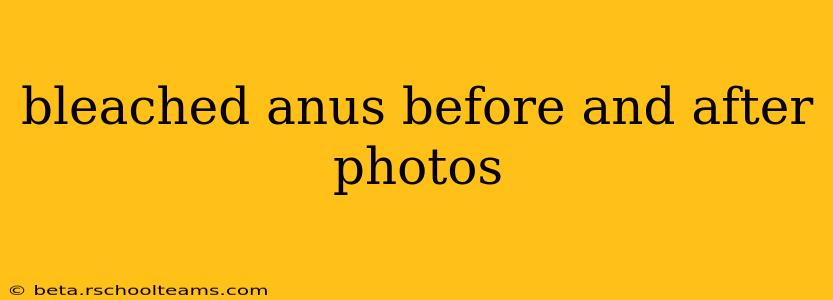 bleached anus before and after photos