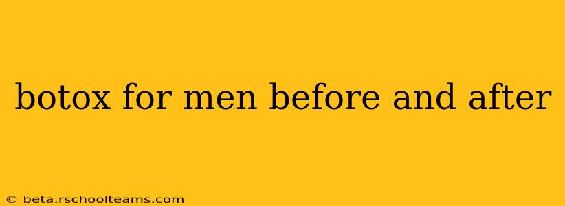 botox for men before and after