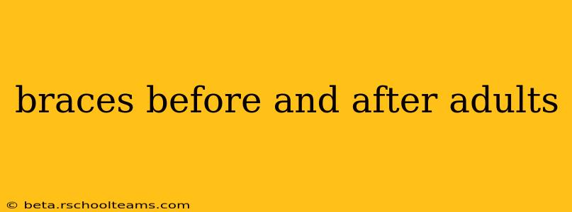 braces before and after adults