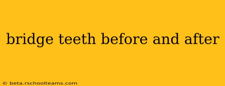 bridge teeth before and after