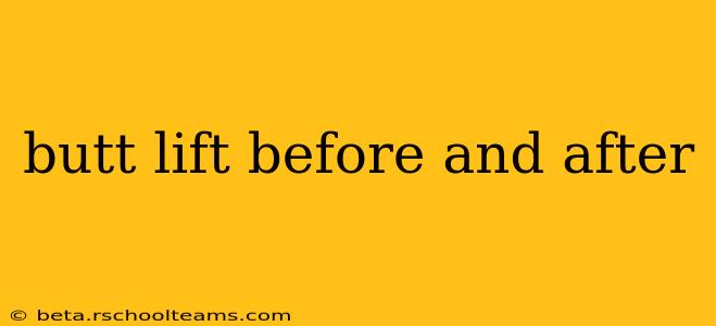 butt lift before and after