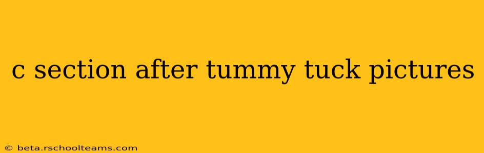 c section after tummy tuck pictures