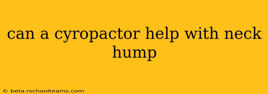 can a cyropactor help with neck hump