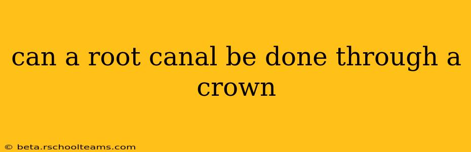 can a root canal be done through a crown