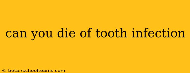 can you die of tooth infection