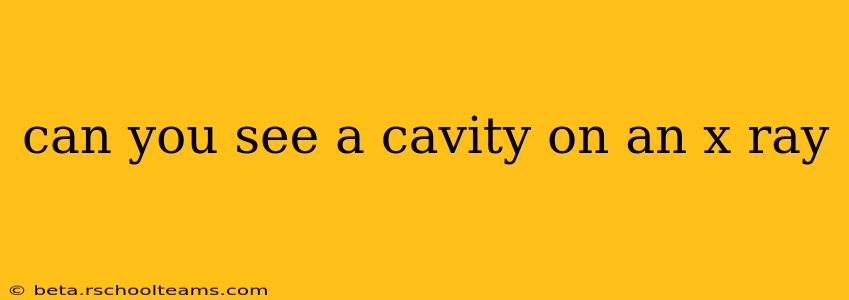 can you see a cavity on an x ray