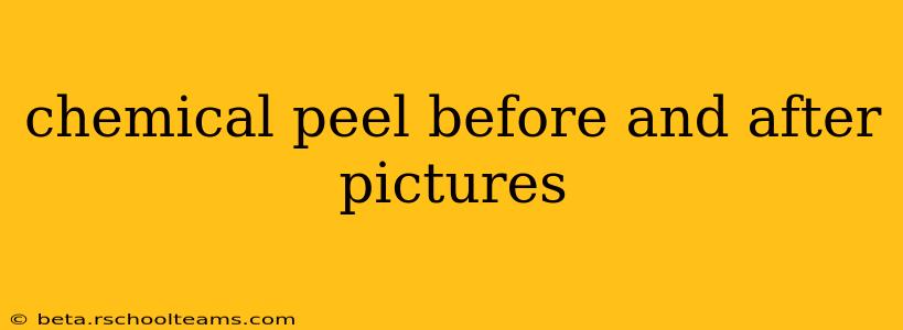 chemical peel before and after pictures