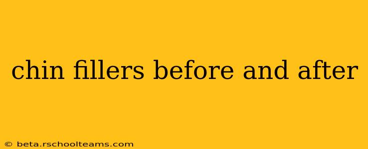 chin fillers before and after