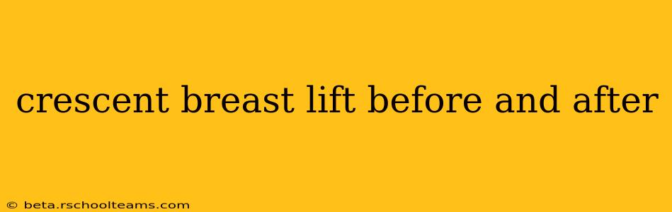 crescent breast lift before and after