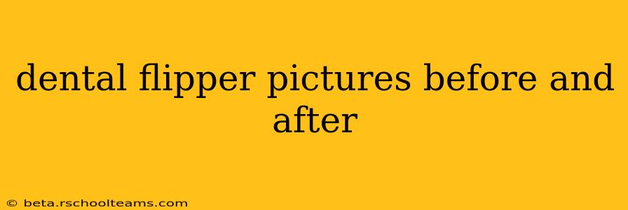 dental flipper pictures before and after
