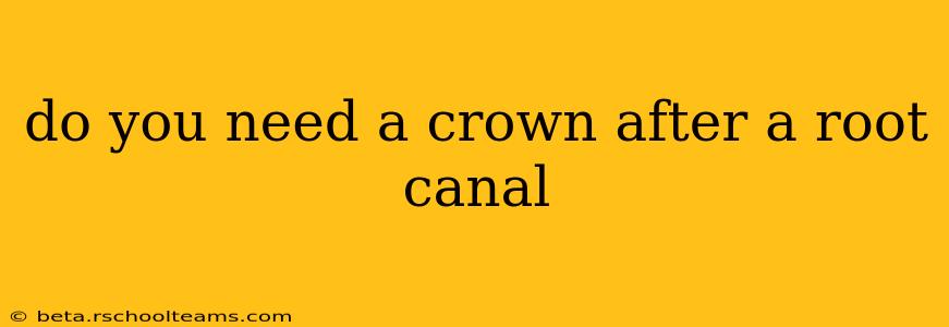 do you need a crown after a root canal