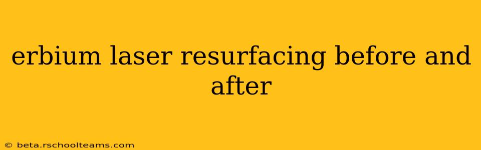 erbium laser resurfacing before and after