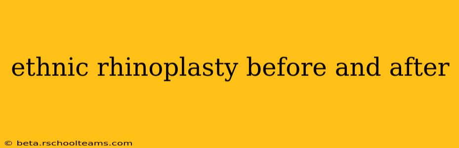 ethnic rhinoplasty before and after