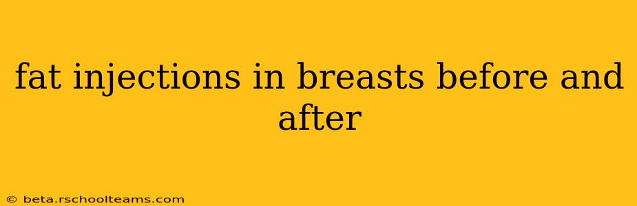 fat injections in breasts before and after