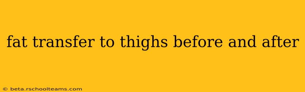 fat transfer to thighs before and after