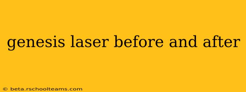 genesis laser before and after