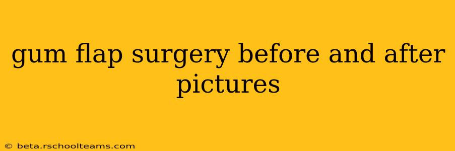 gum flap surgery before and after pictures
