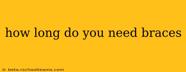 how long do you need braces