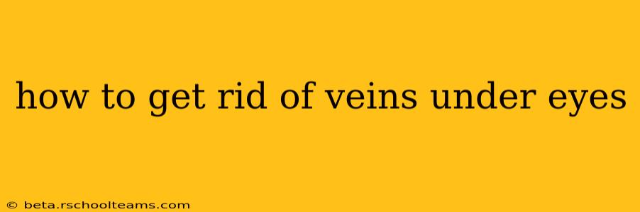 how to get rid of veins under eyes