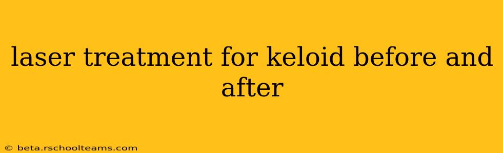 laser treatment for keloid before and after