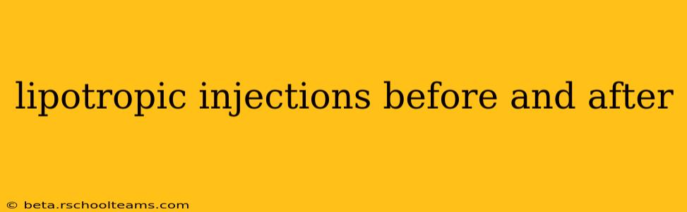 lipotropic injections before and after