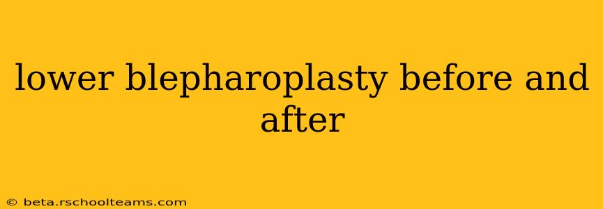 lower blepharoplasty before and after