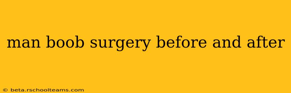 man boob surgery before and after