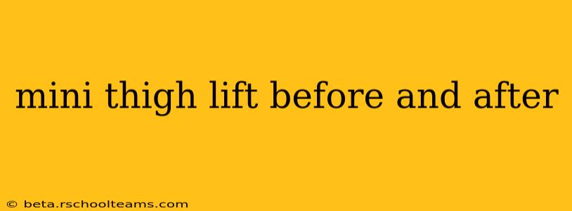 mini thigh lift before and after
