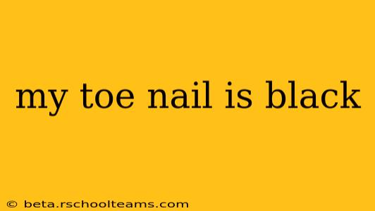 my toe nail is black