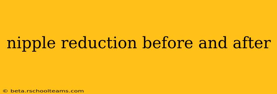 nipple reduction before and after
