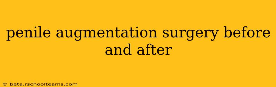 penile augmentation surgery before and after