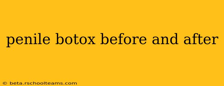 penile botox before and after