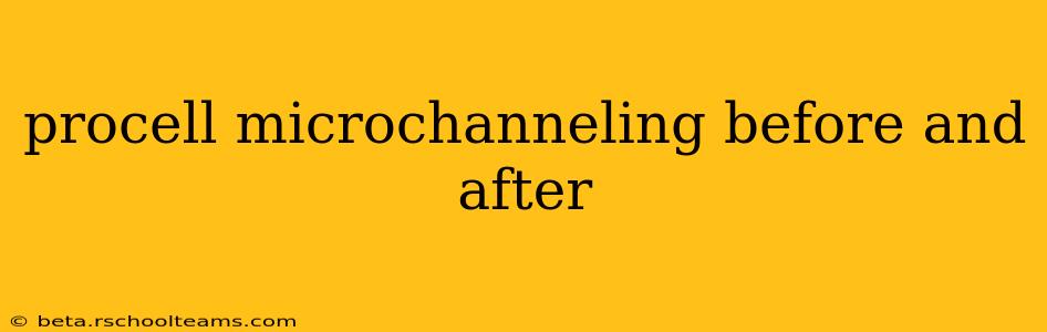 procell microchanneling before and after