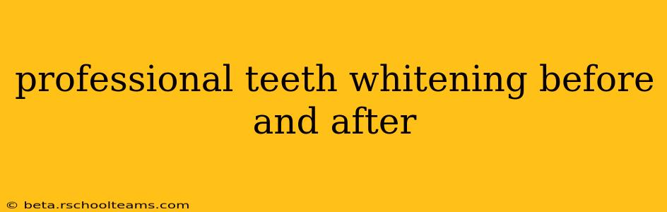 professional teeth whitening before and after