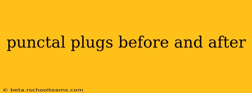 punctal plugs before and after