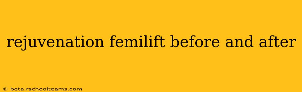 rejuvenation femilift before and after