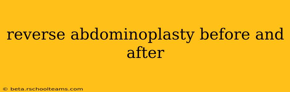 reverse abdominoplasty before and after
