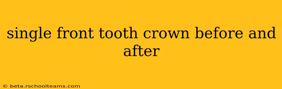 single front tooth crown before and after