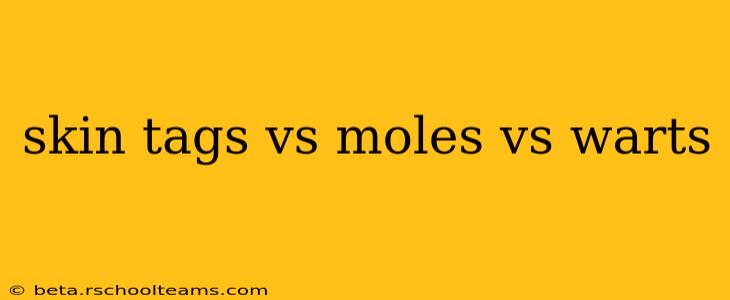 skin tags vs moles vs warts