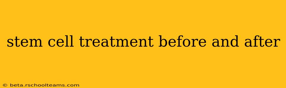stem cell treatment before and after