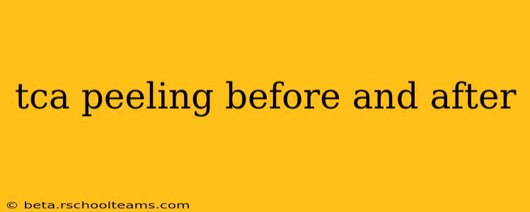 tca peeling before and after