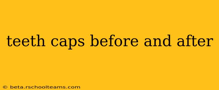 teeth caps before and after