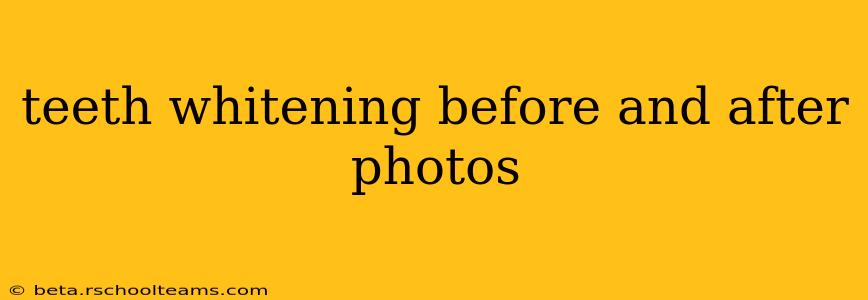 teeth whitening before and after photos